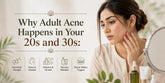 Why Adult Acne Happens in Your 20s and 30s: A Pakistani Dermatologist Explains