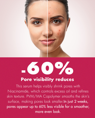 Nicotinamide Serum – 30ml with 5% Niacinamide+Glycerin | Anti-Aging+Pore Minimizer+Dark Spot Corrector with Sodium Hyaluronate | Ultra Hydrating Serum to Target Enlarged Pores | Soothing+Even Skin Tone | Facial Serum For Oily, Acne-Prone & Blemish Skin.