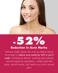 Retinol Serum – 30ml, Retinyl & Ascorbyl Palmitate+Vitamin E+BHA | Skin Booster Serum | Anti-Aging Face Serum for Fine Lines, Wrinkles & Premature Sun Damage | Minimizes Pore Size+Refines Skin Texture | Skin Hydration+Smoothing | Gentle Skin Brightening.