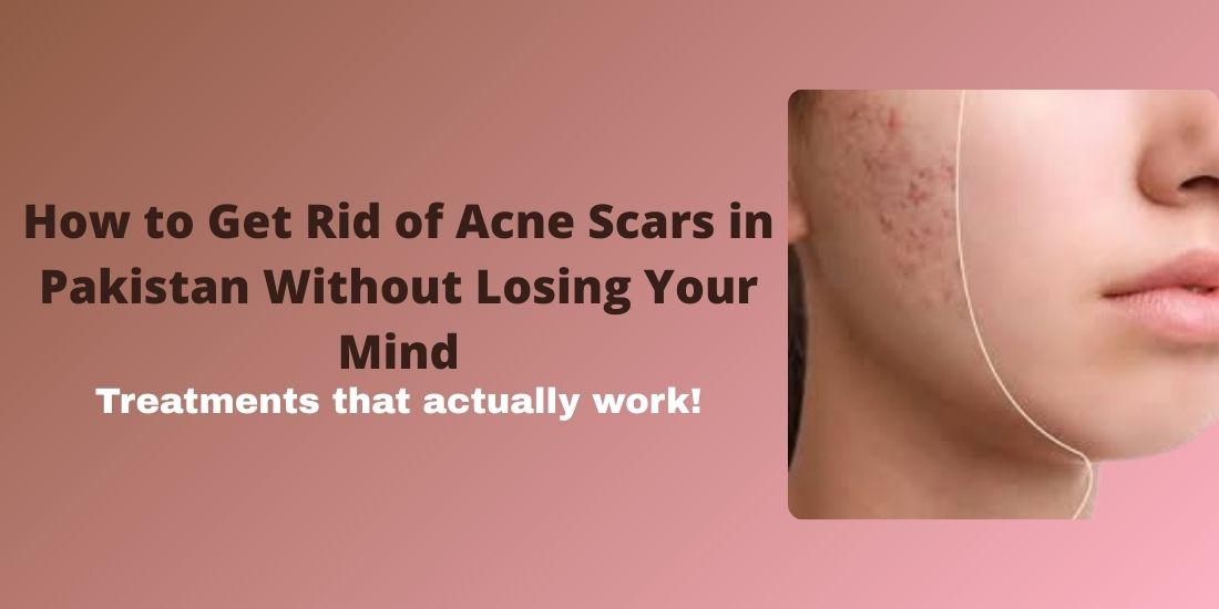 How to Get Rid of Acne Scars in Pakistan