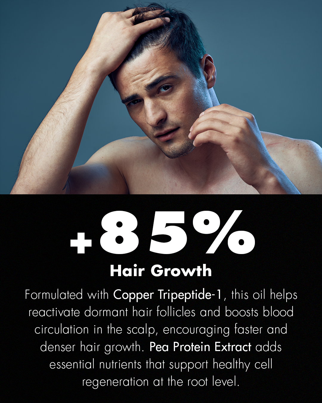 The Needs – Advanced Hair Growth Oil