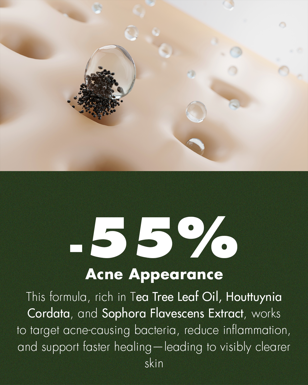 Tea Tree Anti-Acne Serum – Clarify & Calm Breakouts