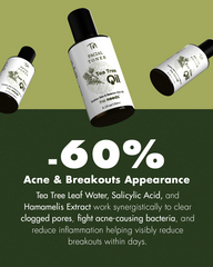 Tea Tree Toner – 150 ml, Tea Tree Leaf Extract+Witch Hazel | Sodium Hyaluronate+Niacinamide | Oil & Sebum Control+Skin Soothing | Balanced pH | | Face Priming+Hydrating+Refreshing | Lightweight Facial Toner | Exfoliating+Calming | Support Skin Barrier.